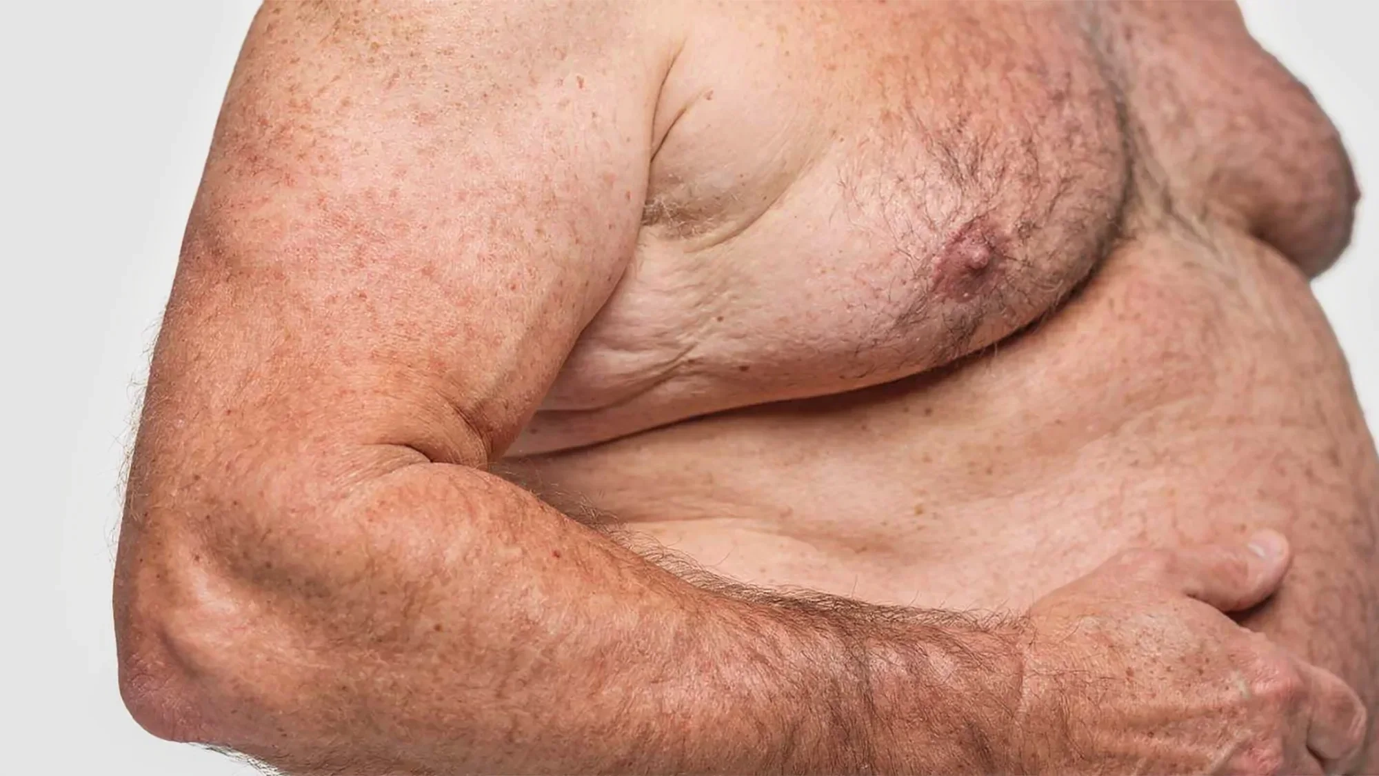AI-generated close view of a folded arm resting against a soft, freckled chest and stomach