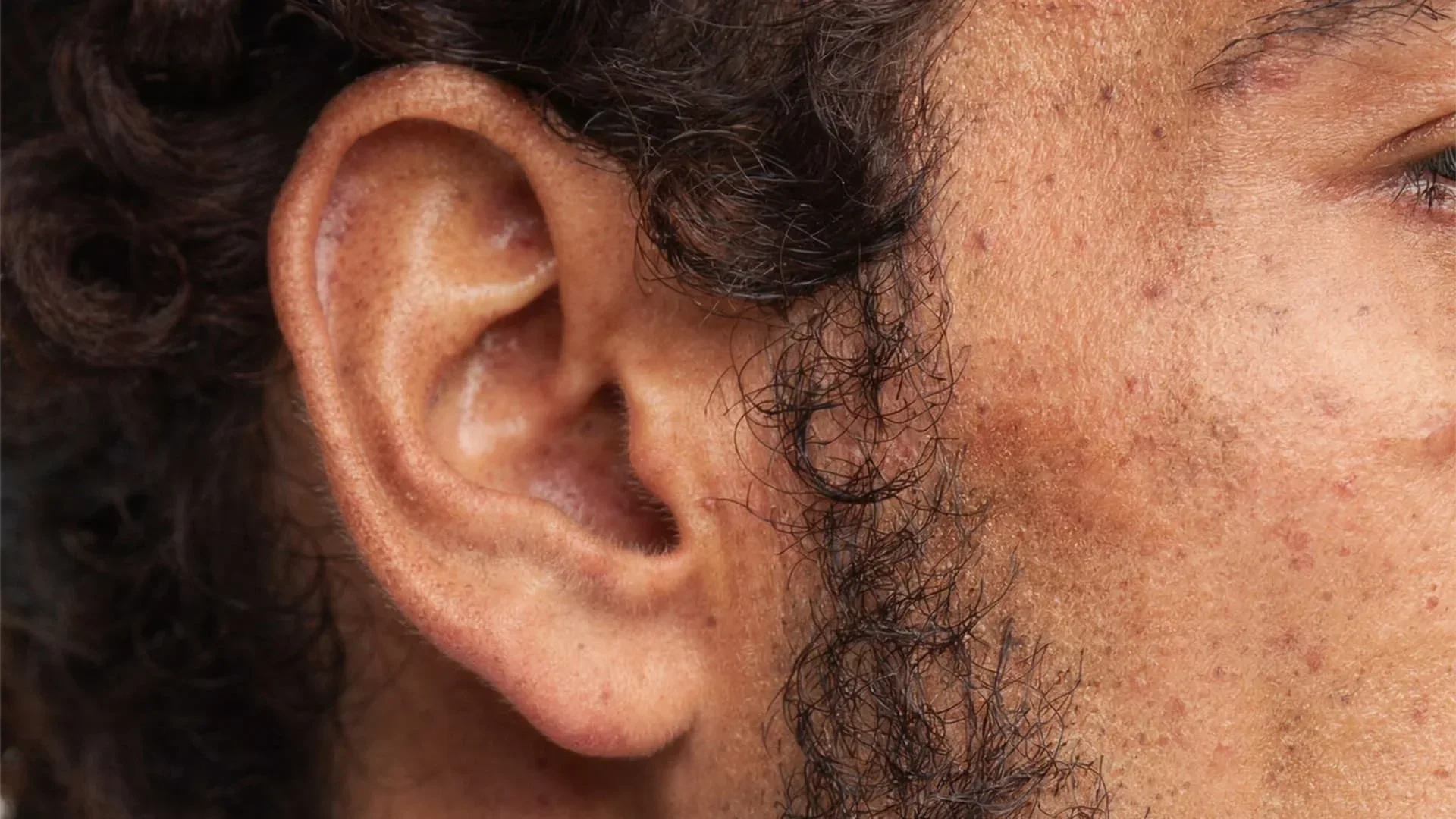 AI-generated close view of the same fictional man's ear, temple and beard, with pores, freckles and small marks visible
